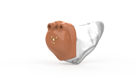 audífonos Intracanal (ITC) audiser bogota