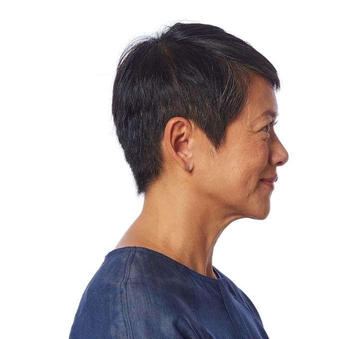 audífono Receptor en el Canal (RIC) para AUDISER en Bogotá